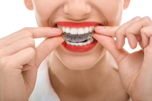 Invisalign®: The Path to Healthier Teeth